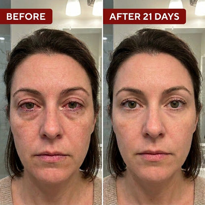 Beminda Steam Therapy Pro