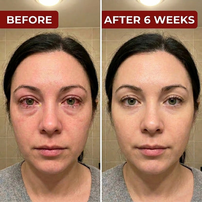 Beminda Steam Therapy Pro