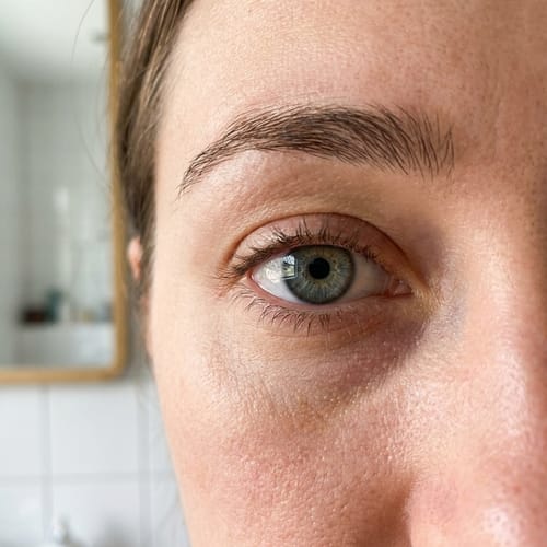 Loox customer photo — Mandy O.'s close-up of her eye after using the Steam Therapy Pro